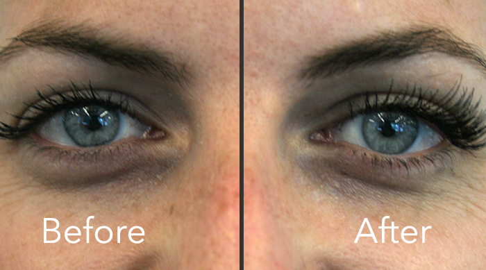 Before and After magnetic eyelash extensions
